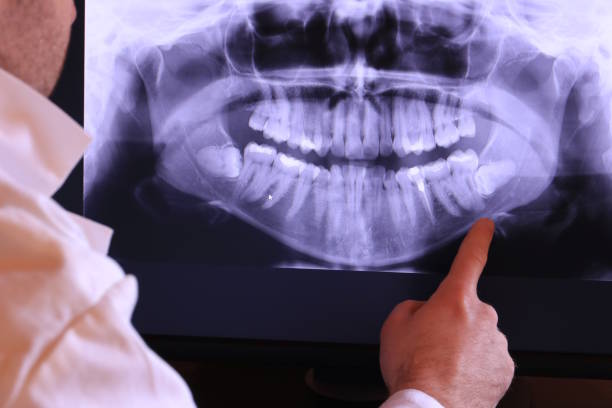 Best Emergency Dentist for Lost Fillings or Crowns in Freeport, TX